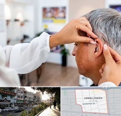 دکتر کم شنوایی در خیابان جمالزاده