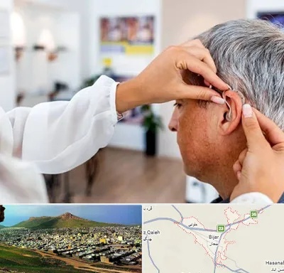 دکتر کم شنوایی در بیجار