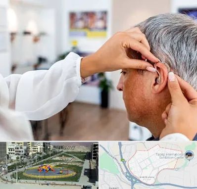 دکتر کم شنوایی در مرزداران تبریز