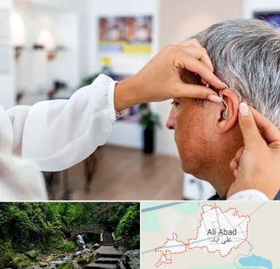 دکتر کم شنوایی در علی آباد کتول