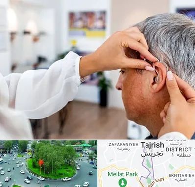 دکتر کم شنوایی در تجریش 