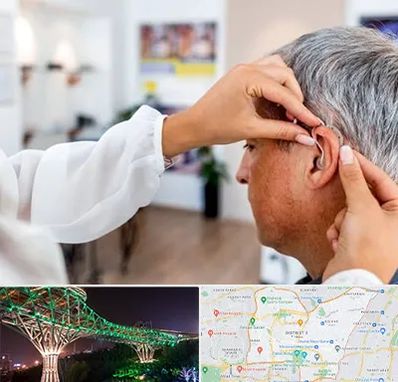 دکتر کم شنوایی در منطقه 3 تهران 