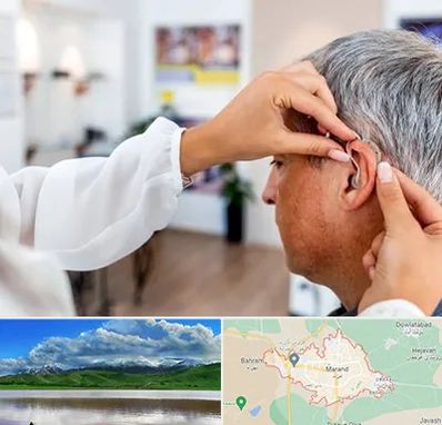 دکتر کم شنوایی در مرند