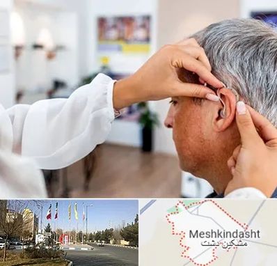 دکتر کم شنوایی در مشکین دشت