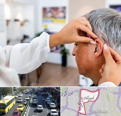 دکتر کم شنوایی در امیرآباد