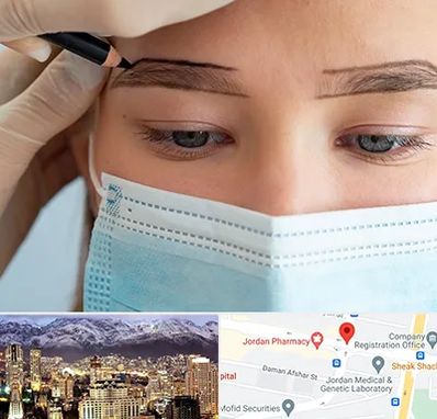 کاشت ابرو در جردن 