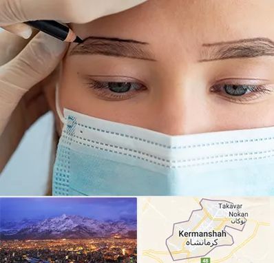 کاشت ابرو در کرمانشاه