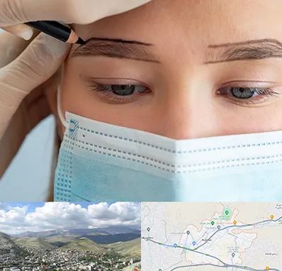 کاشت ابرو در رودهن