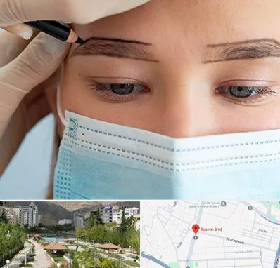 کاشت ابرو در بلوار تعاون