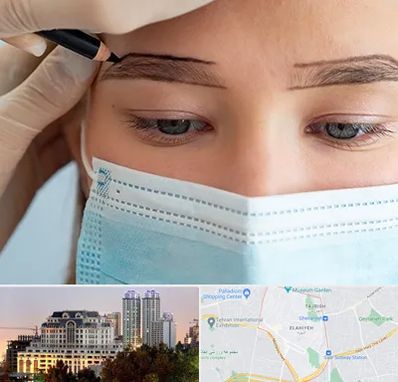 کاشت ابرو در فرشته 