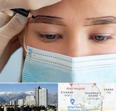 کاشت ابرو در شهرک غرب 