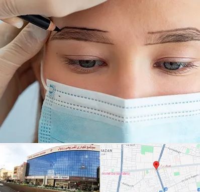 کاشت ابرو در نصف راه تبریز