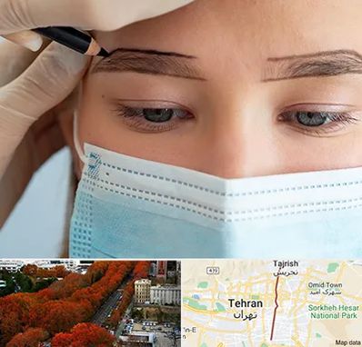 کاشت ابرو در ولیعصر 