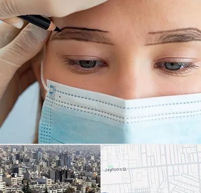 کاشت ابرو در جیحون