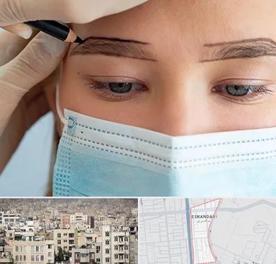 کاشت ابرو در اسکندری