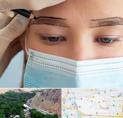 کاشت ابرو در کن 