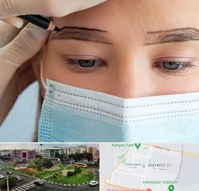 کاشت ابرو در تهرانسر 