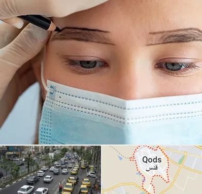 کاشت ابرو در شهر قدس