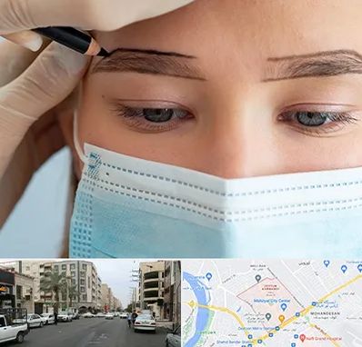 کاشت ابرو در زیتون کارمندی اهواز 