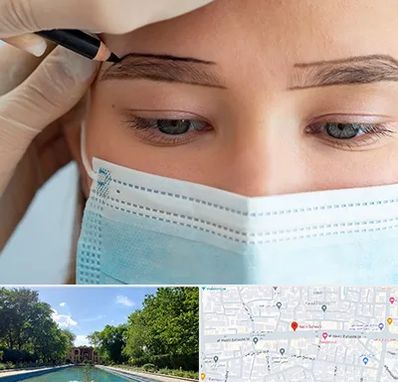 کاشت ابرو در هشت بهشت اصفهان 