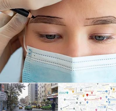 کاشت ابرو در فاطمی 