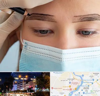 کاشت ابرو در کیانپارس اهواز 