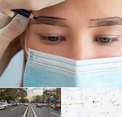 کاشت ابرو در دولت 