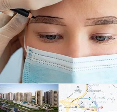 کاشت ابرو در المپیک 