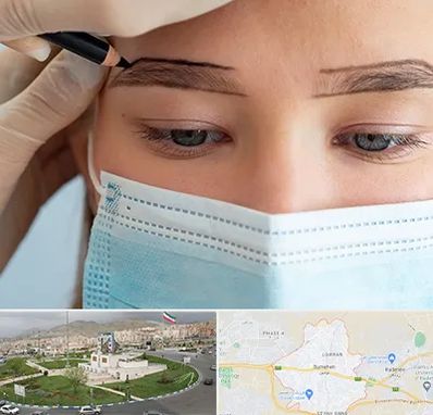 کاشت ابرو در بومهن