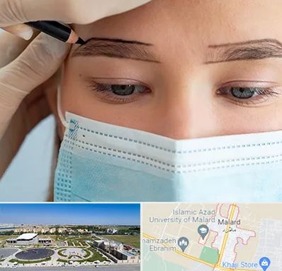 کاشت ابرو در ملارد