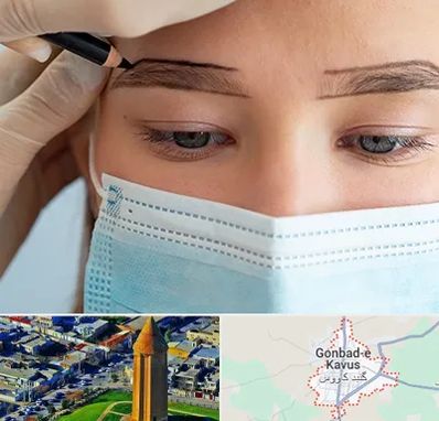 کاشت ابرو در گنبد کاووس