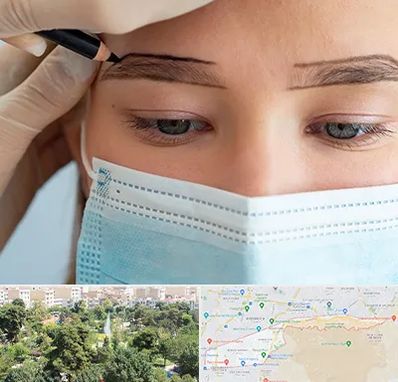 کاشت ابرو در منطقه 13 تهران 