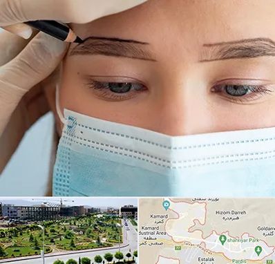 کاشت ابرو در پردیس