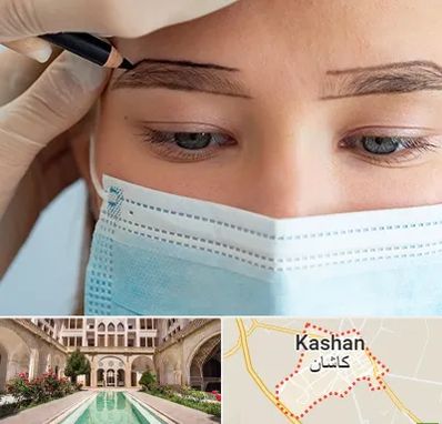 کاشت ابرو در کاشان