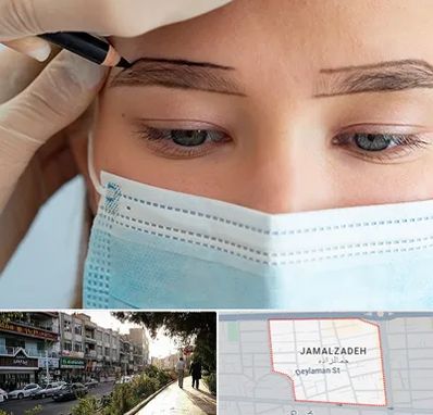 کاشت ابرو در خیابان جمالزاده