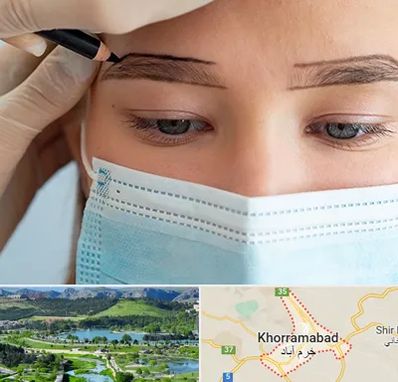 کاشت ابرو در خرم آباد