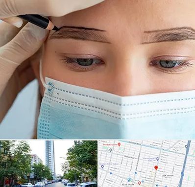 کاشت ابرو در امامت مشهد 