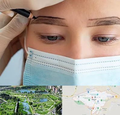 کاشت ابرو در بجنورد