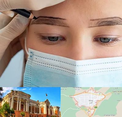 کاشت ابرو در خوی