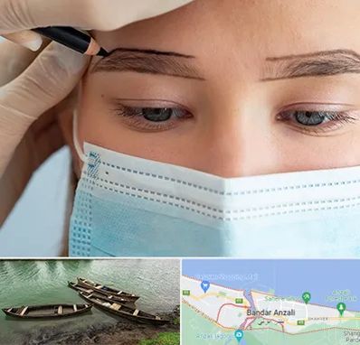 کاشت ابرو در بندر انزلی