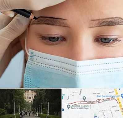 کاشت ابرو در بلوار معلم رشت 