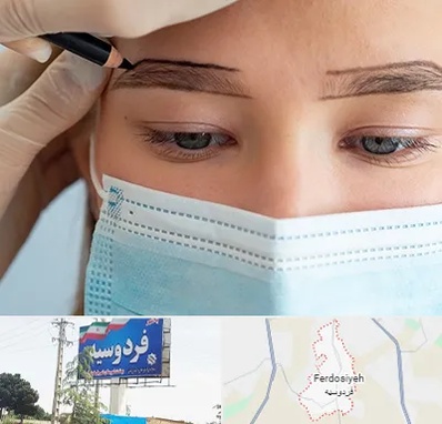 کاشت ابرو در فردوسیه شهریار