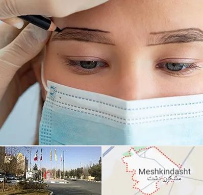 کاشت ابرو در مشکین دشت