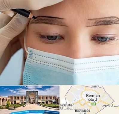 کاشت ابرو در کرمان