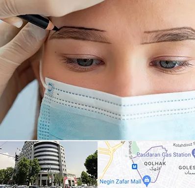کاشت ابرو در قلهک 