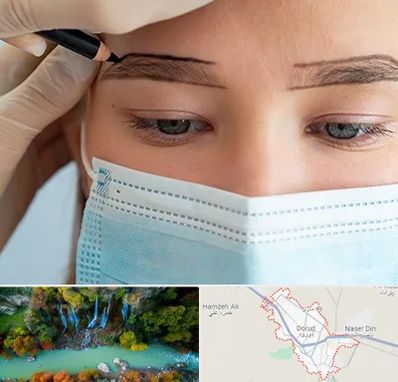 کاشت ابرو در دورود