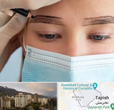 کاشت ابرو در زعفرانیه 