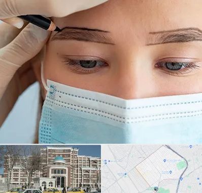 کاشت ابرو در طلاب مشهد