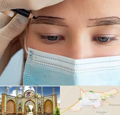 کاشت ابرو در سمنان