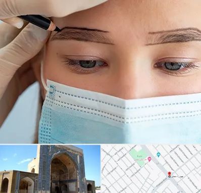 کاشت ابرو در مصلی مشهد